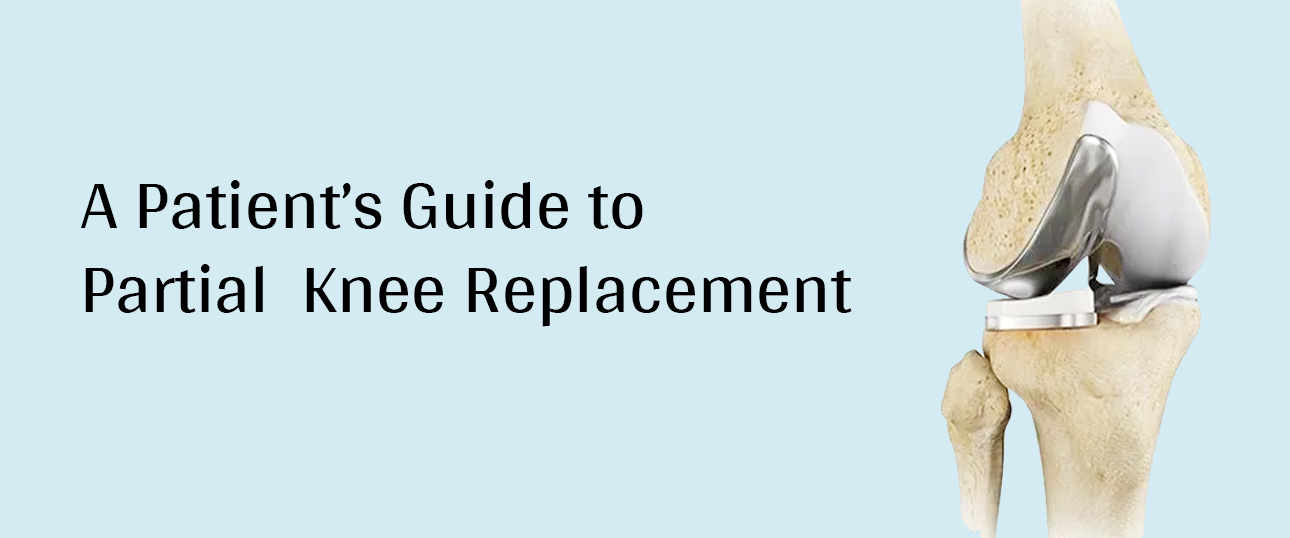 Knee Replacement